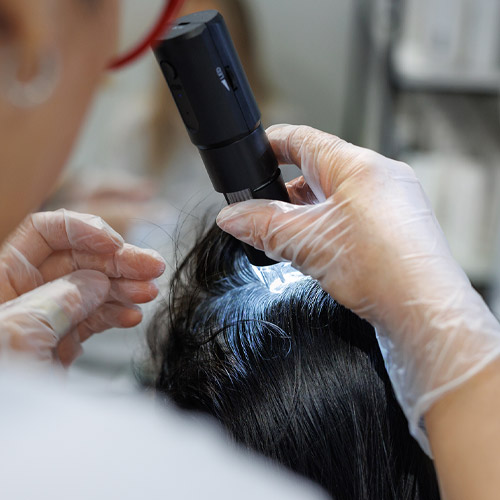 Haare und Kopfhaut Behandlungen