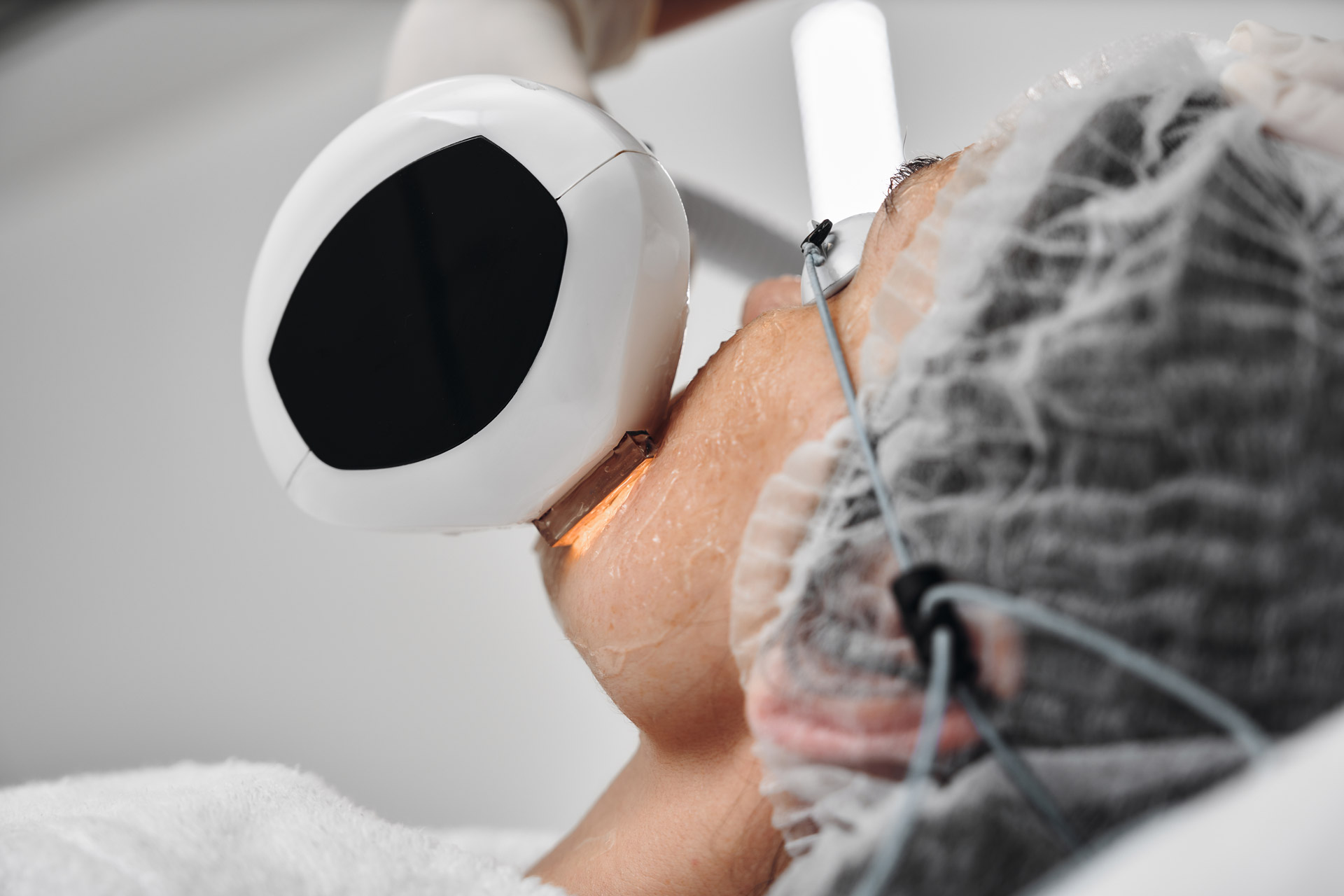 Skin Boutique Laser Treatments