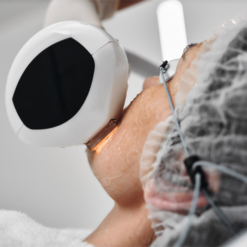 Skin Boutique Signature Laser Treatments